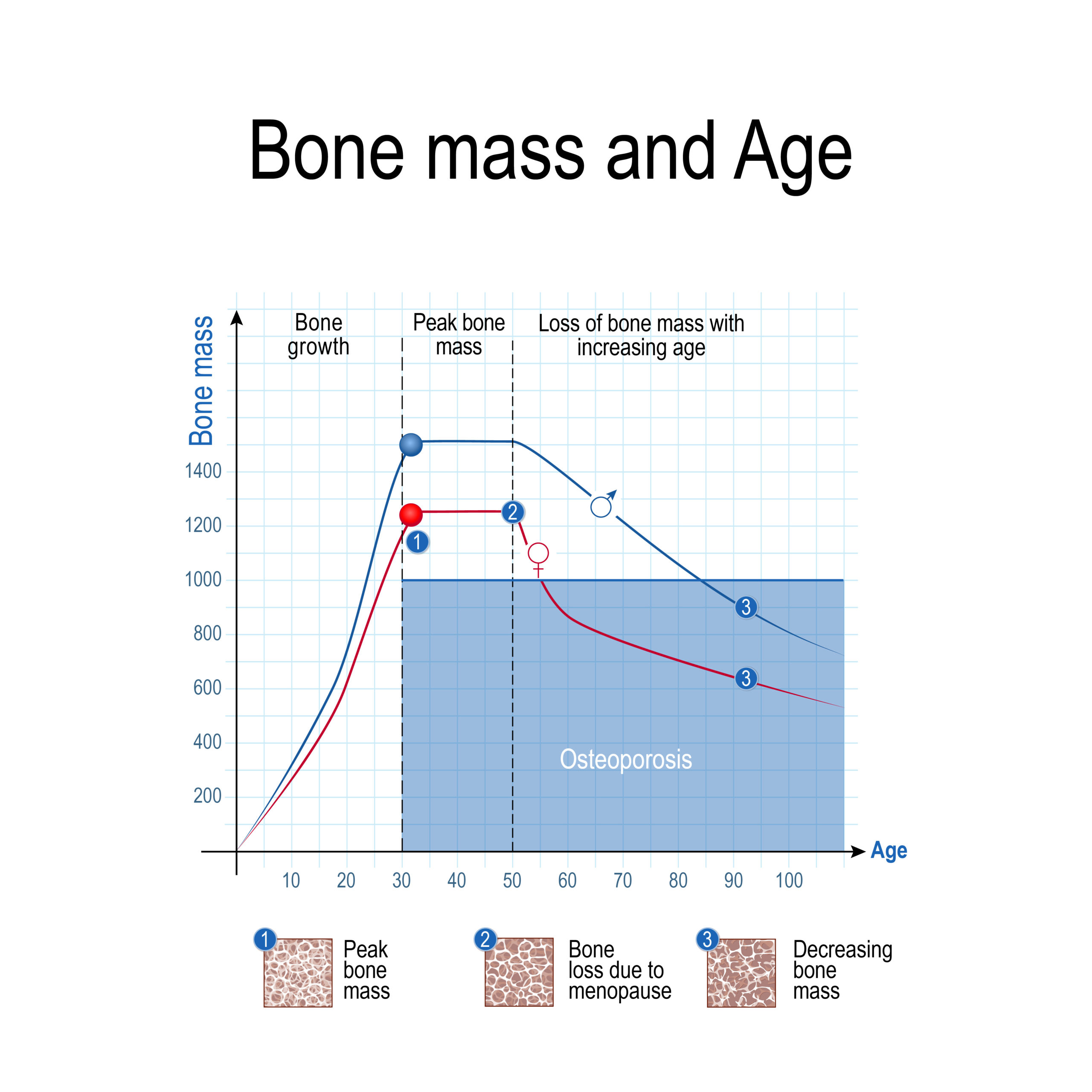 Bone mass for male and female. Age and osteoporosis. Chart. healthy lifestyle. Vector illustration for educational, science and medical use